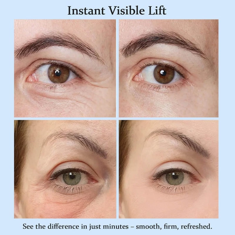 Quick Fix Eye Lift Cream Revitalizes Tired Eyes