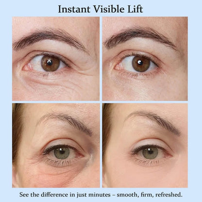 Quick Fix Eye Lift Cream Revitalizes Tired Eyes